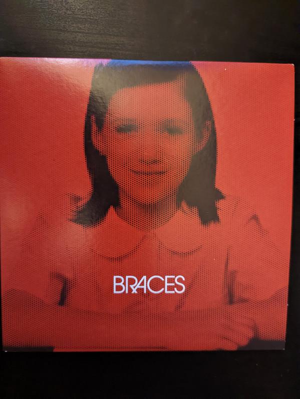 Braces - Braces
