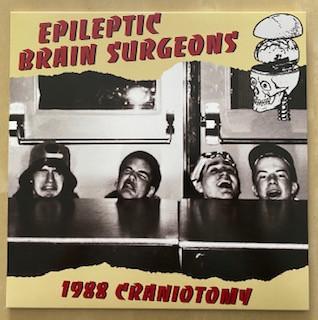 Epileptic Brain Surgeons - 1988 Craniotomy